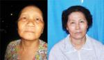 Mắc bệnh hiểm nghèo, 2 phụ nữ cần sự giúp đỡ