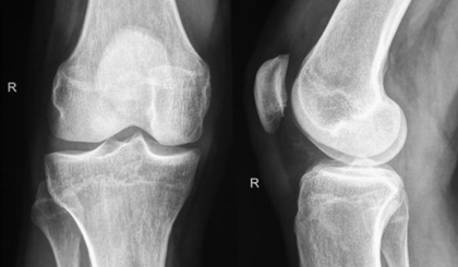 (Nguồn: Medical News Today)