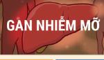 Những điều cần biết về Gan nhiễm mỡ