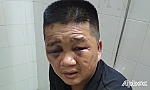 Bắt đối tượng trộm tài sản có nhiều tiền án