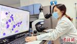 Thiết bị y tế AI - bước đột phá trong quy trình xét nghiệm máu
