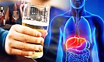 Bệnh lý liên quan đến nghiện rượu